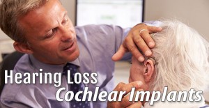 Cochlear Implants